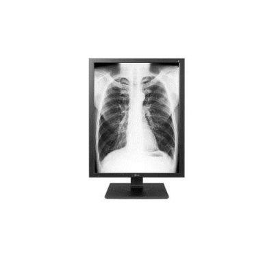  Lg Medical Diagnostic 3mp 60hz Monitor Rouge One Size / EU Plug